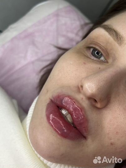 Услуги Косметолога