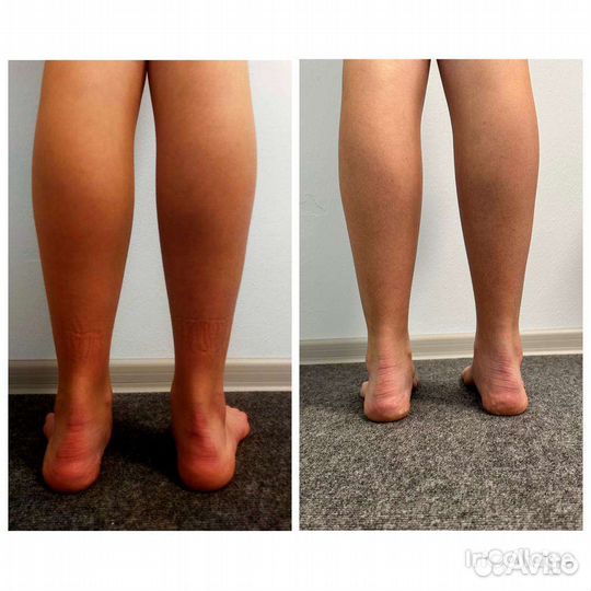 Детский массаж