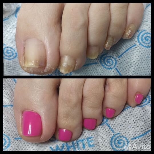 Мастер педикюра, подология