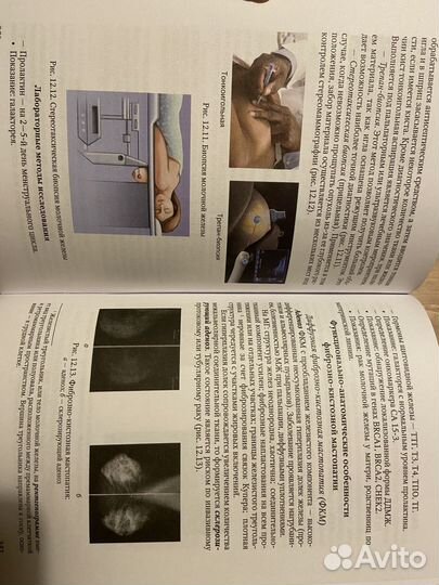 Гинекология Шмидт А. А. спецлит