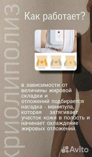 Процедура криолиполиз