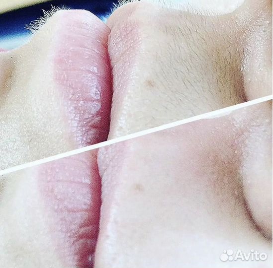 Шугаринг/ваксинг