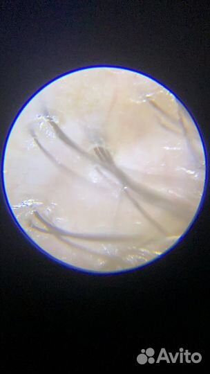 Пилинг для кожи головы подбор домашнего ухода