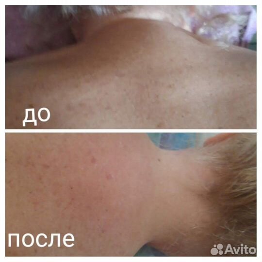 Массажист, обертывание, шугаринг