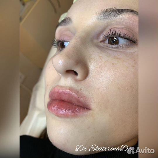 Врач дерматолог, косметолог