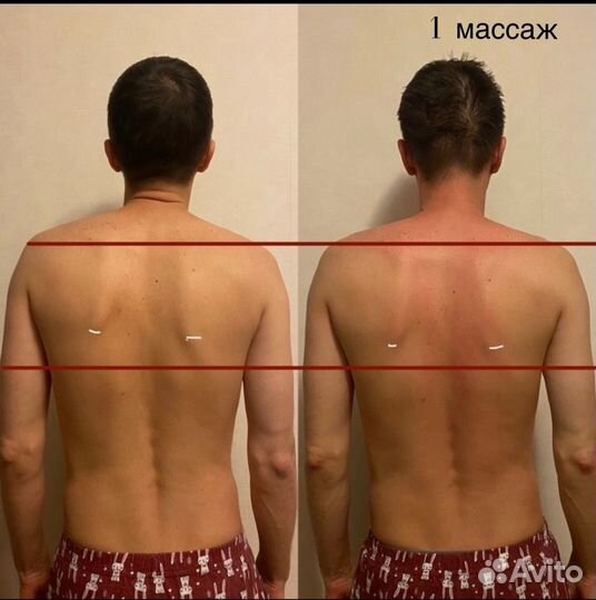 Массаж лица и тела