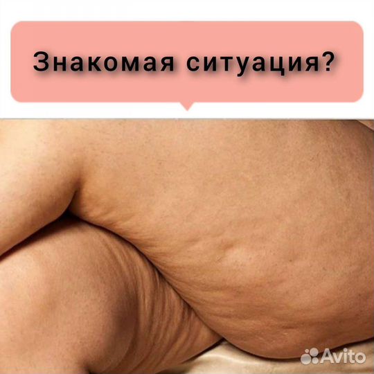 Аппаратный вакуумный массаж, кавитация, и др