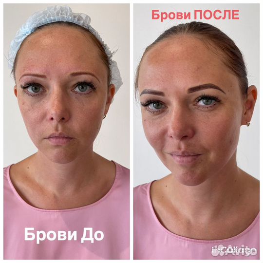 Консультация косметолога