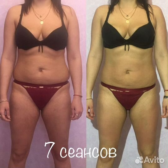 Курс LPG массажа 10 сеансов по 45 мин