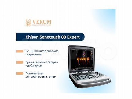 Узи аппарат Chison Sonotouch 80 Expert