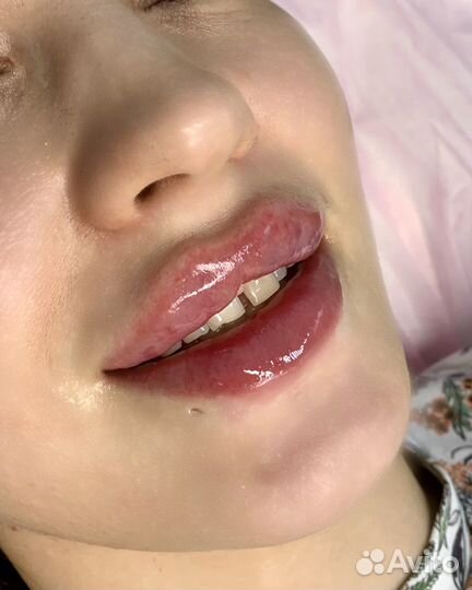 Врач косметолог