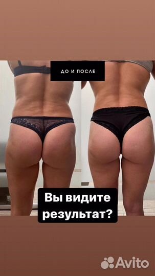 Массаж коррекция фигуры