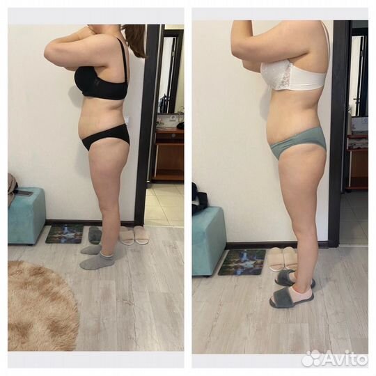 LPG массаж в кошелеве