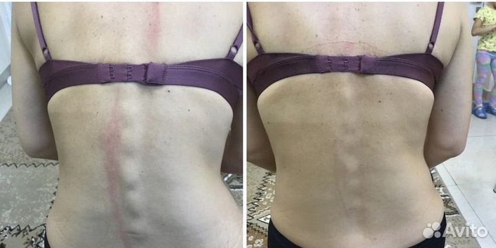 Мануальный массаж. Костоправ. Хиропрактик