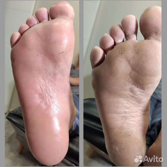 Маникюр, педикюр