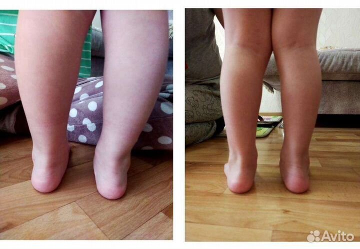 Детский массаж