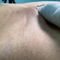 Профессиональный спа-шугаринг и восковая эпиляция, Егорьевск