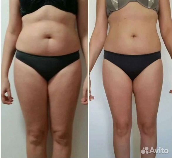 Аппаратный вакуумный массаж тела и лица