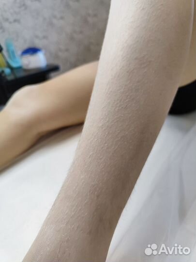 Восковая депиляция