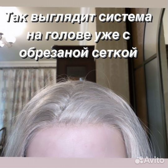 Новая система замещения волос