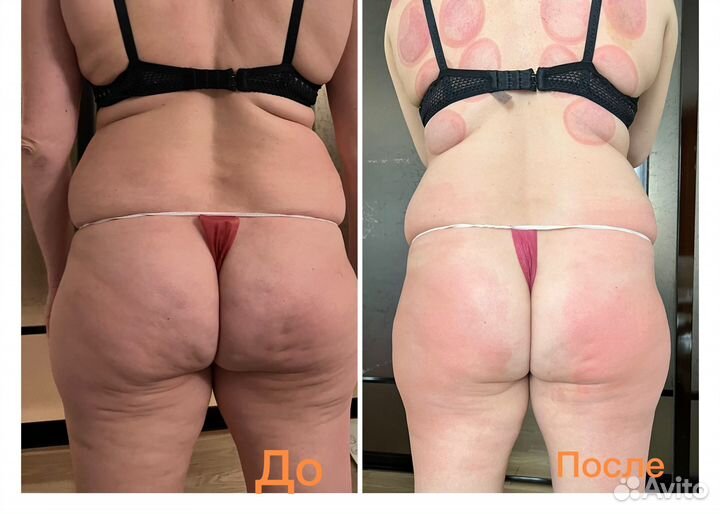 Виски-пеленание styx,гелевое обертывание cello-GEL