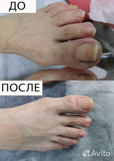 Подолог с медицинским образованием