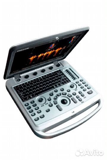 Узи-аппарат Chison SonoBook 6