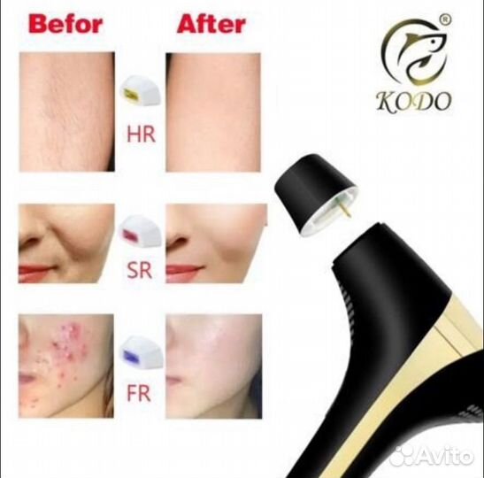 Лазерный эпилятор-избавься от волос навсегда