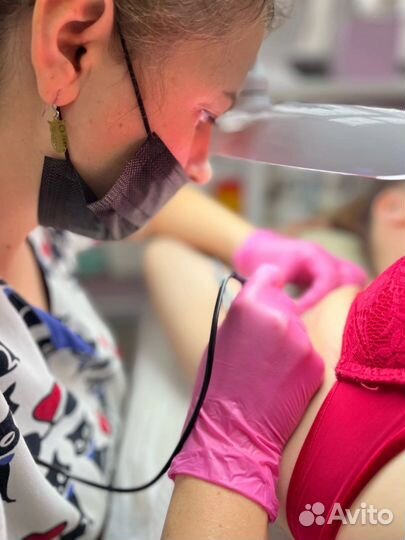 Обучение электроэпиляции