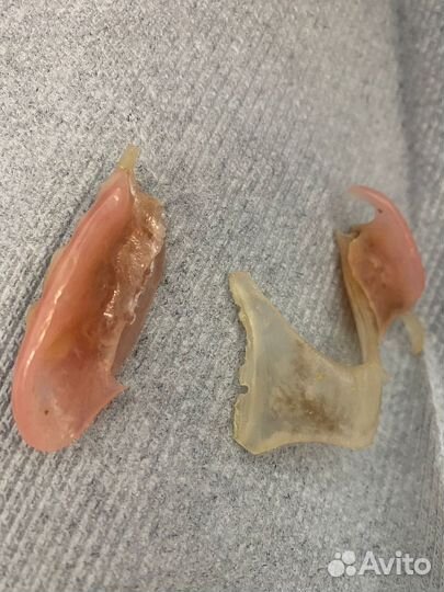 Ремонт съёмных зубных протезов