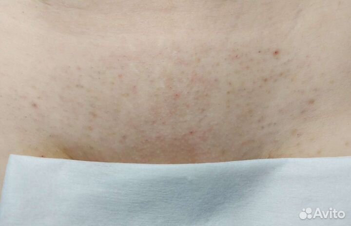 Шугаринг,воск