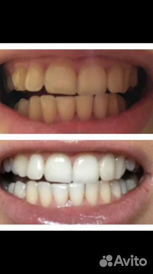 Двухуровневая система отбеливания Crest 3D White