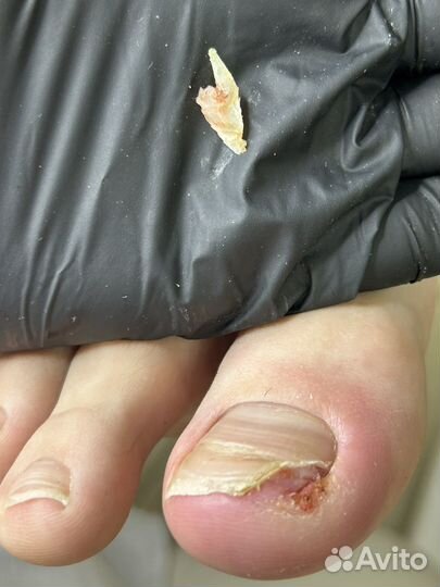 Маникюр - педикюр(подолог)