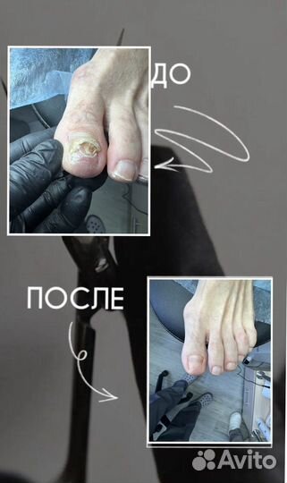Педикюр/маникюр
