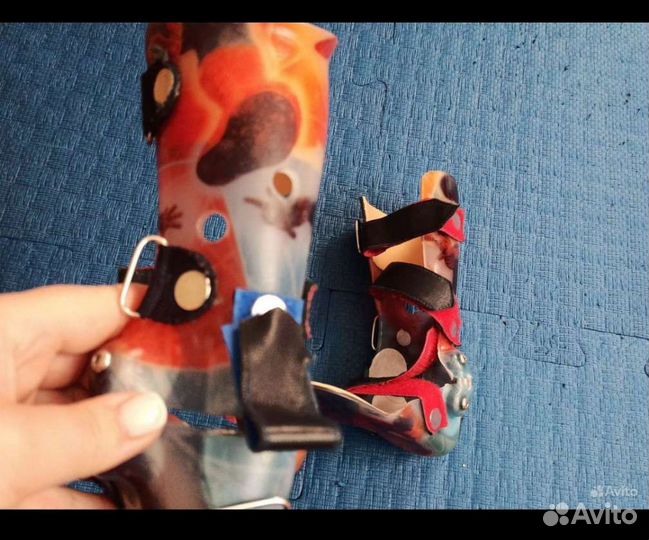 Аппарат на голеностоп