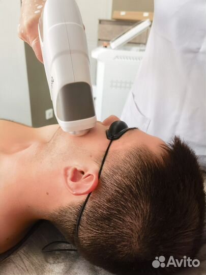 Лазерная эпиляция