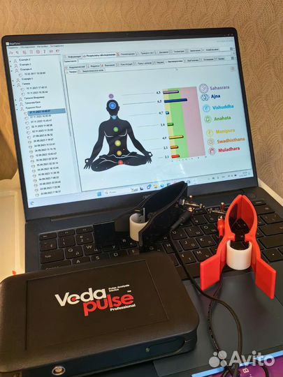Ведапульс- аппарат пульсовой диагностики. Аюрведа