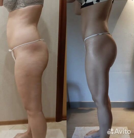 Коррекция силуэта