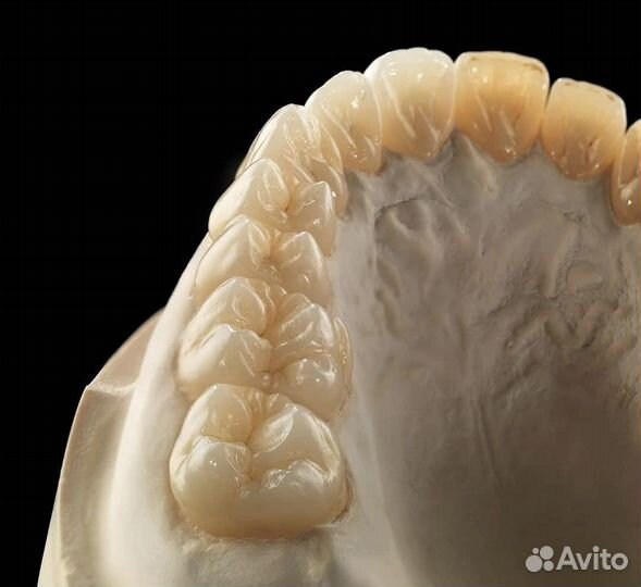 Изготовление зубных протезов (зубов )