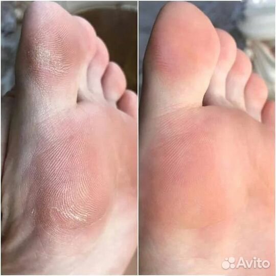 Мастер педикюра, Подолог