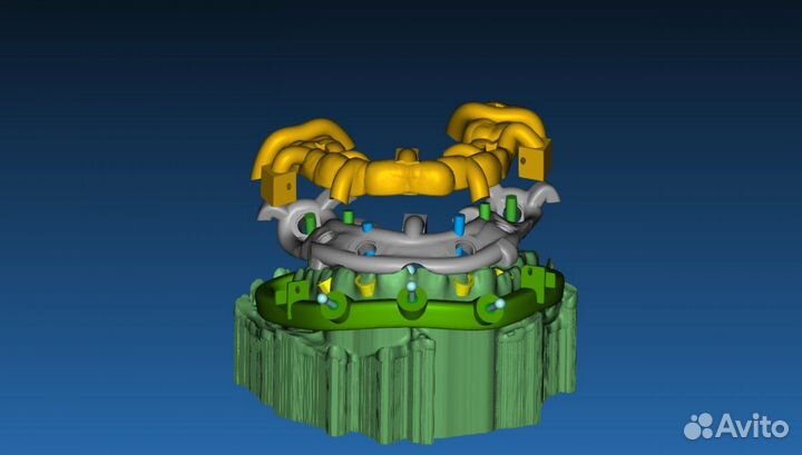 Создание навигационных хирургических шаблонов
