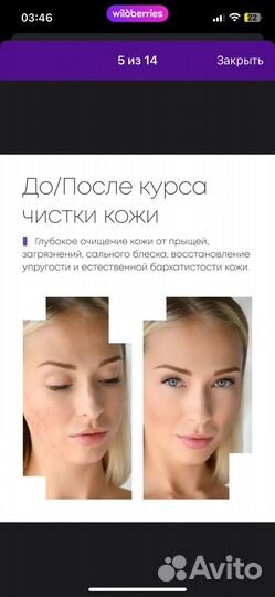 Ультразвуковой аппарат для чистки лица