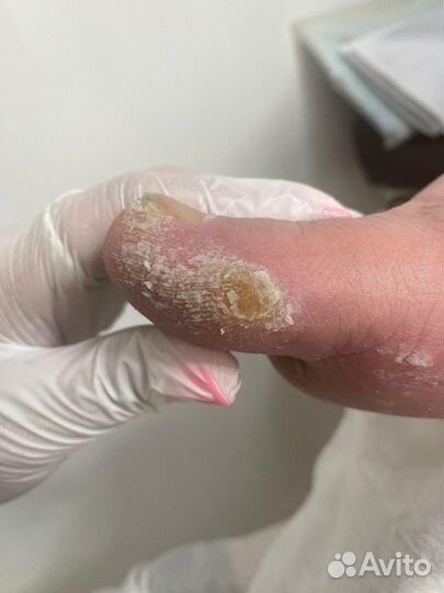 Бесплатная консультация подолога