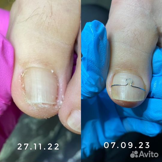 Подолог. Педикюр