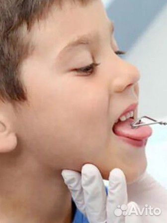 Логопедический зондовый массаж