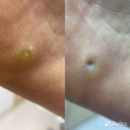 Услуги подолога