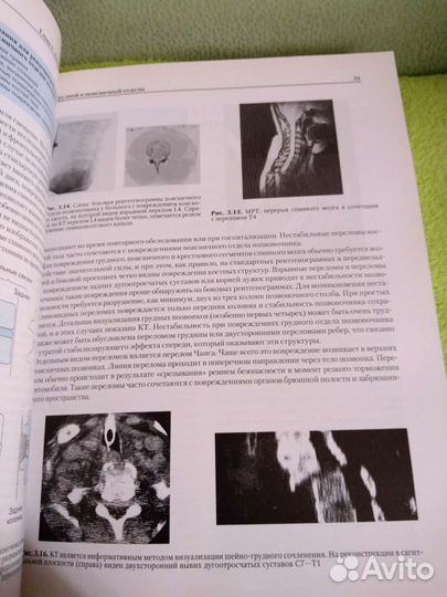 Дэвид Гранди, Эндрю Суэйн Травма спинного мозга