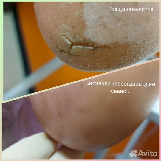 Подологический педикюр Маркс, район