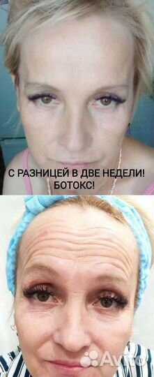 Услуги косметолога