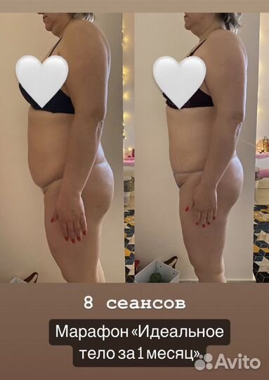 Массаж, коррекция фигуры, активное похудение